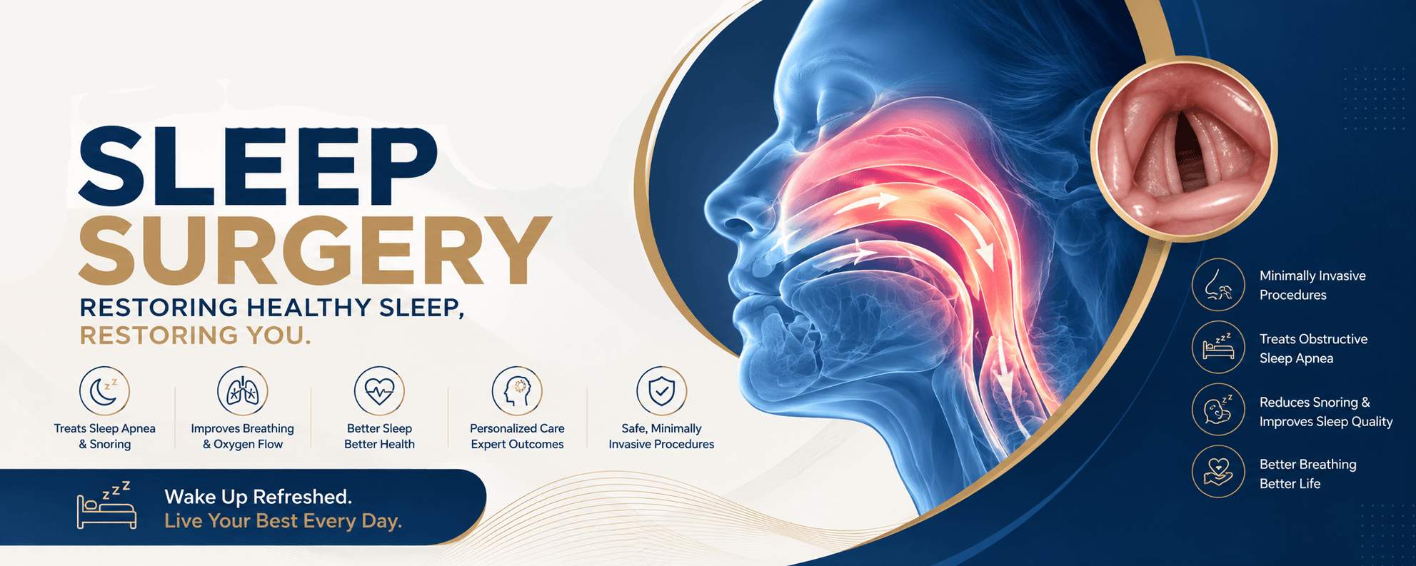 sleep surgery better sleep, better health (1)